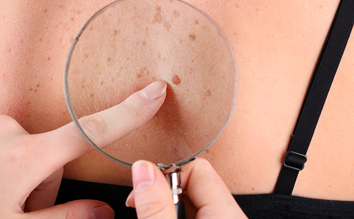 Visita dermatologica Firenze