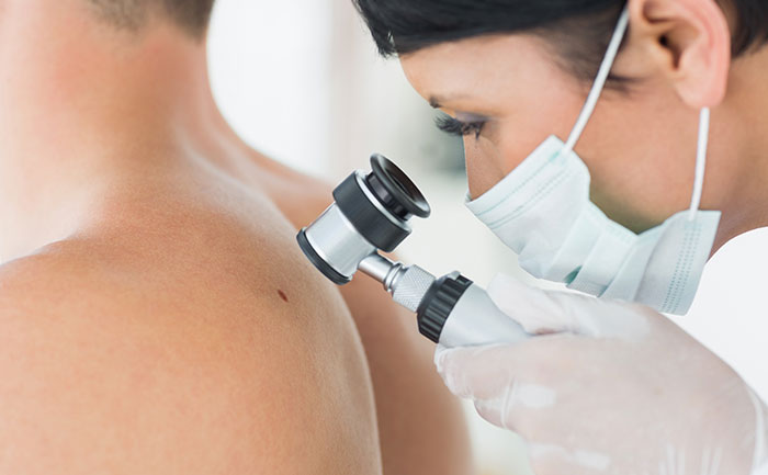 Diagnosi tumori della pelle
