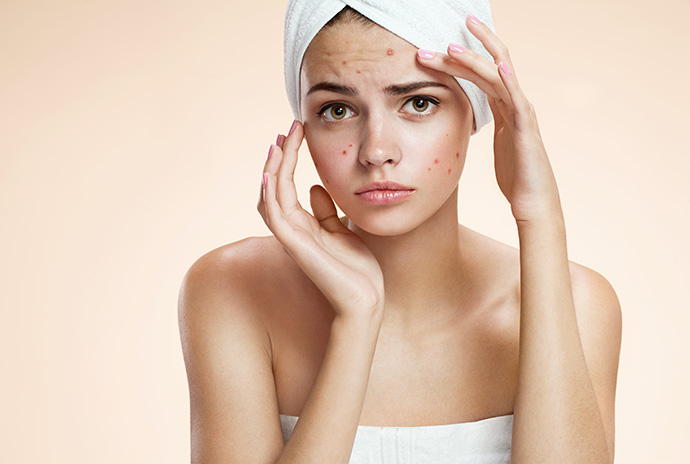 trattamento acne_medlight