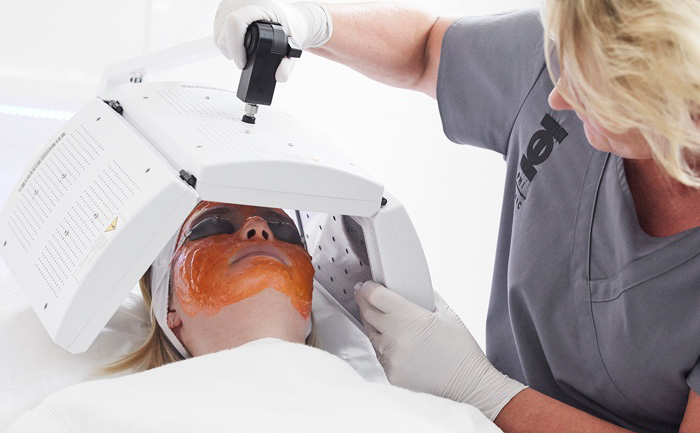 Trattamento biofotonico acne